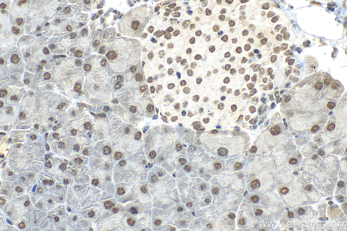 IHC staining of mouse pancreas using 11176-1-AP