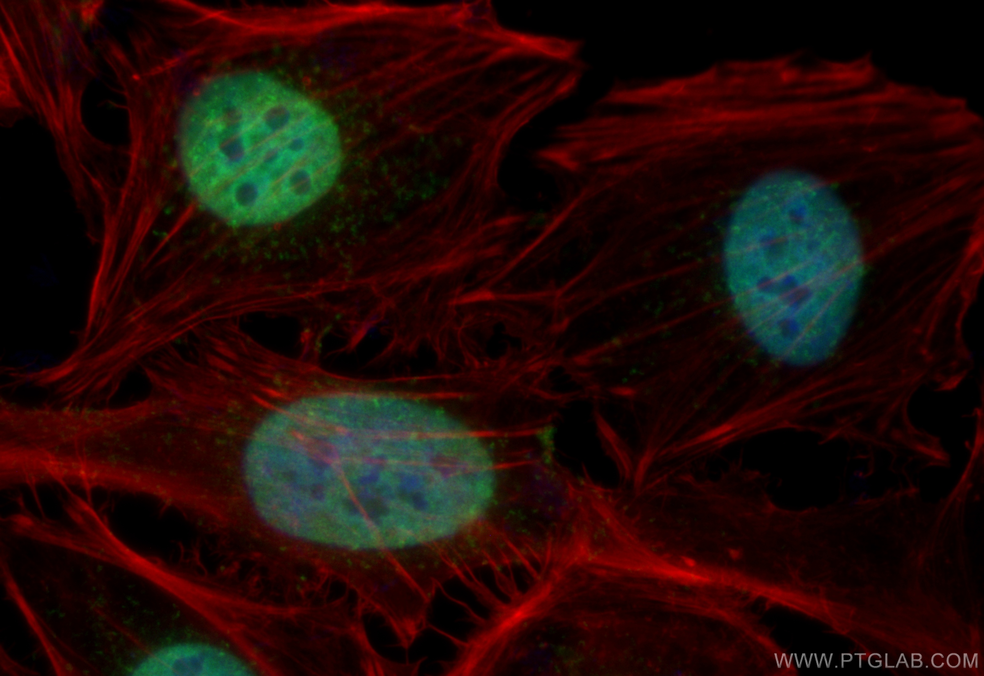 IF Staining of HeLa using 67844-1-Ig