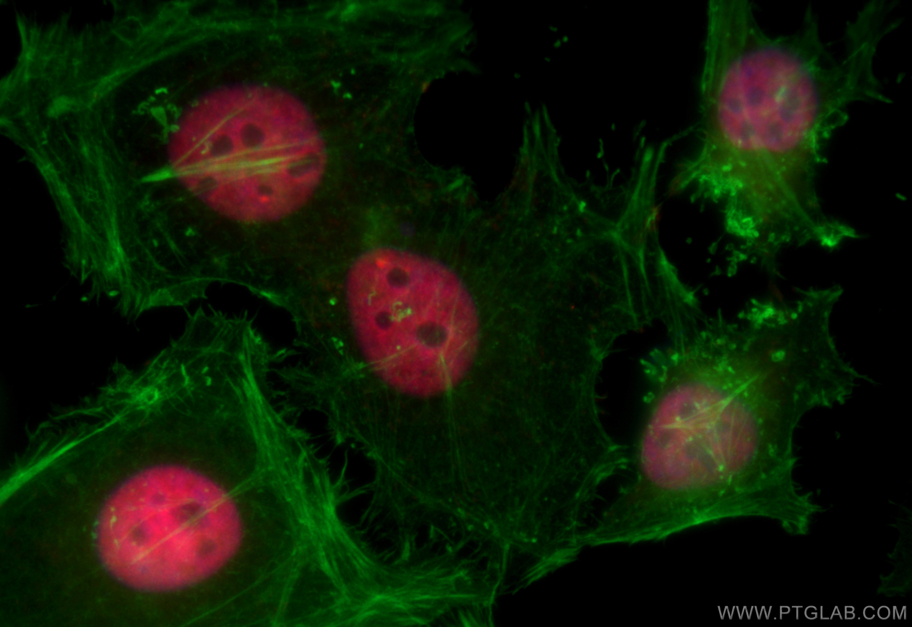 IF Staining of HeLa using CL594-67844