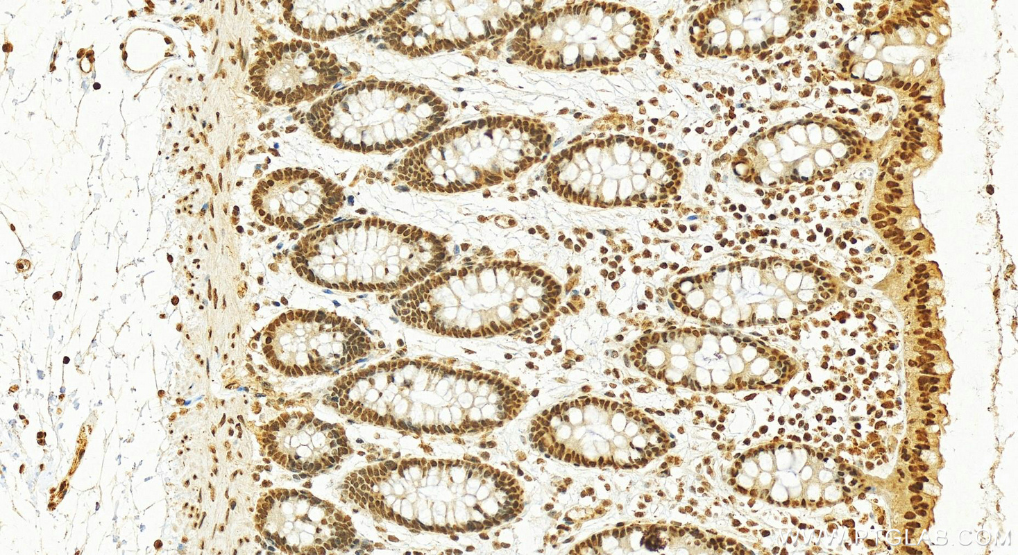 IHC staining of human colon using 14813-1-AP