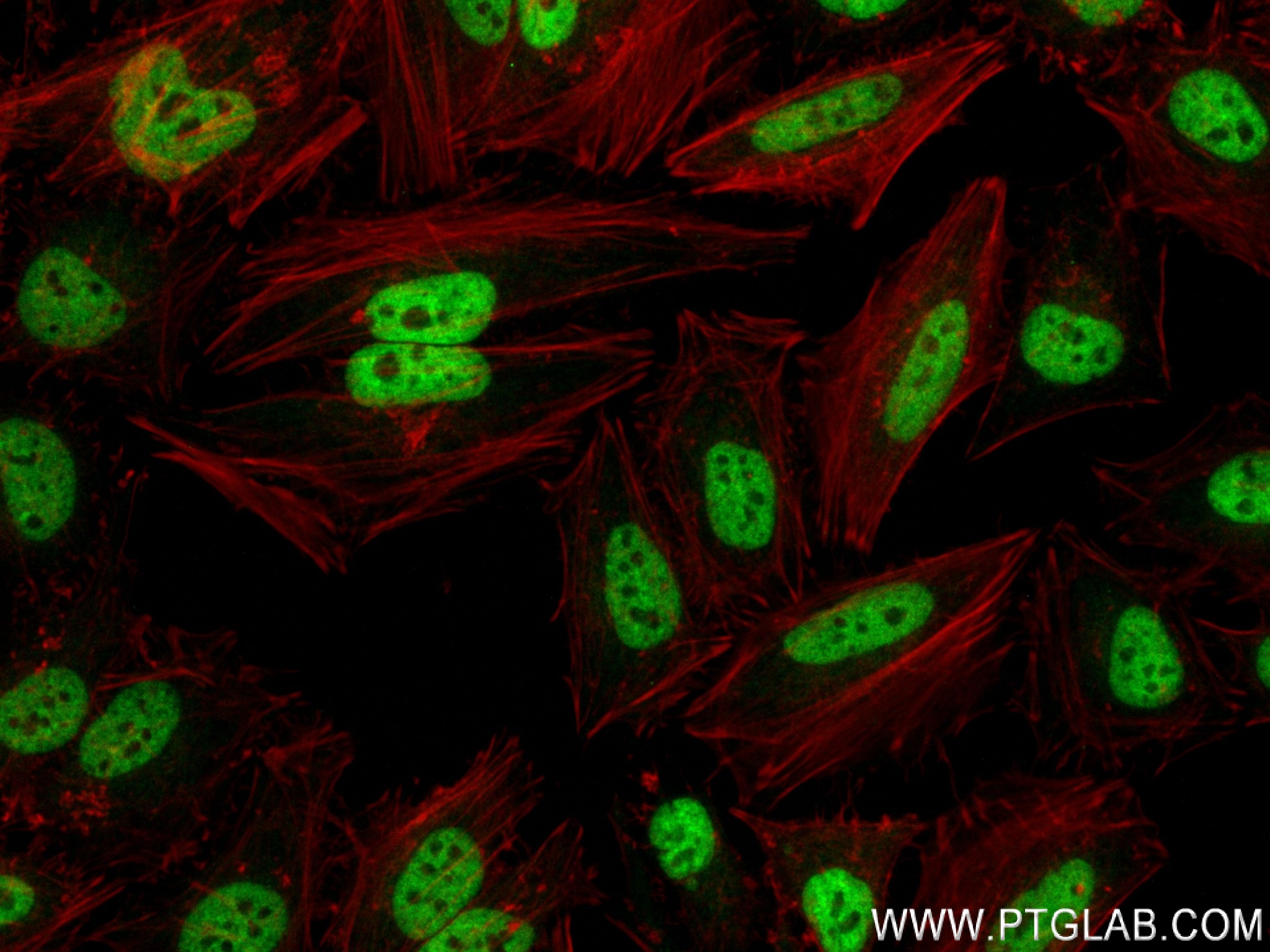 IF Staining of HeLa using 83773-7-RR