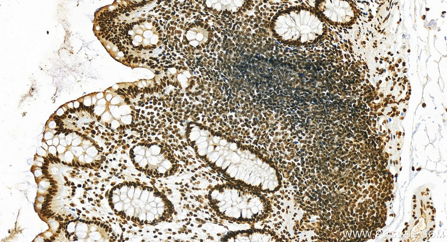 IHC staining of human  colon using 25142-1-AP