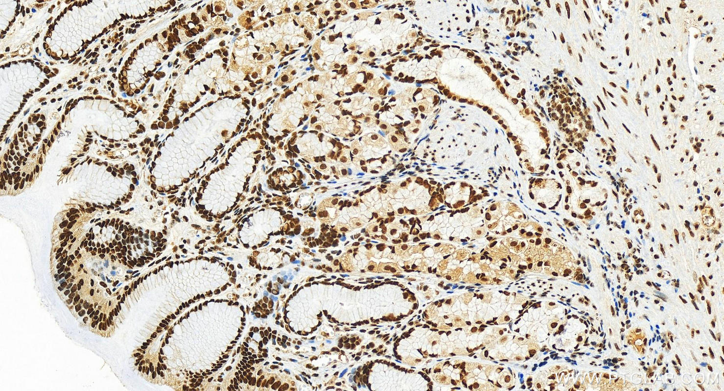 IHC staining of human stomach using 25142-1-AP