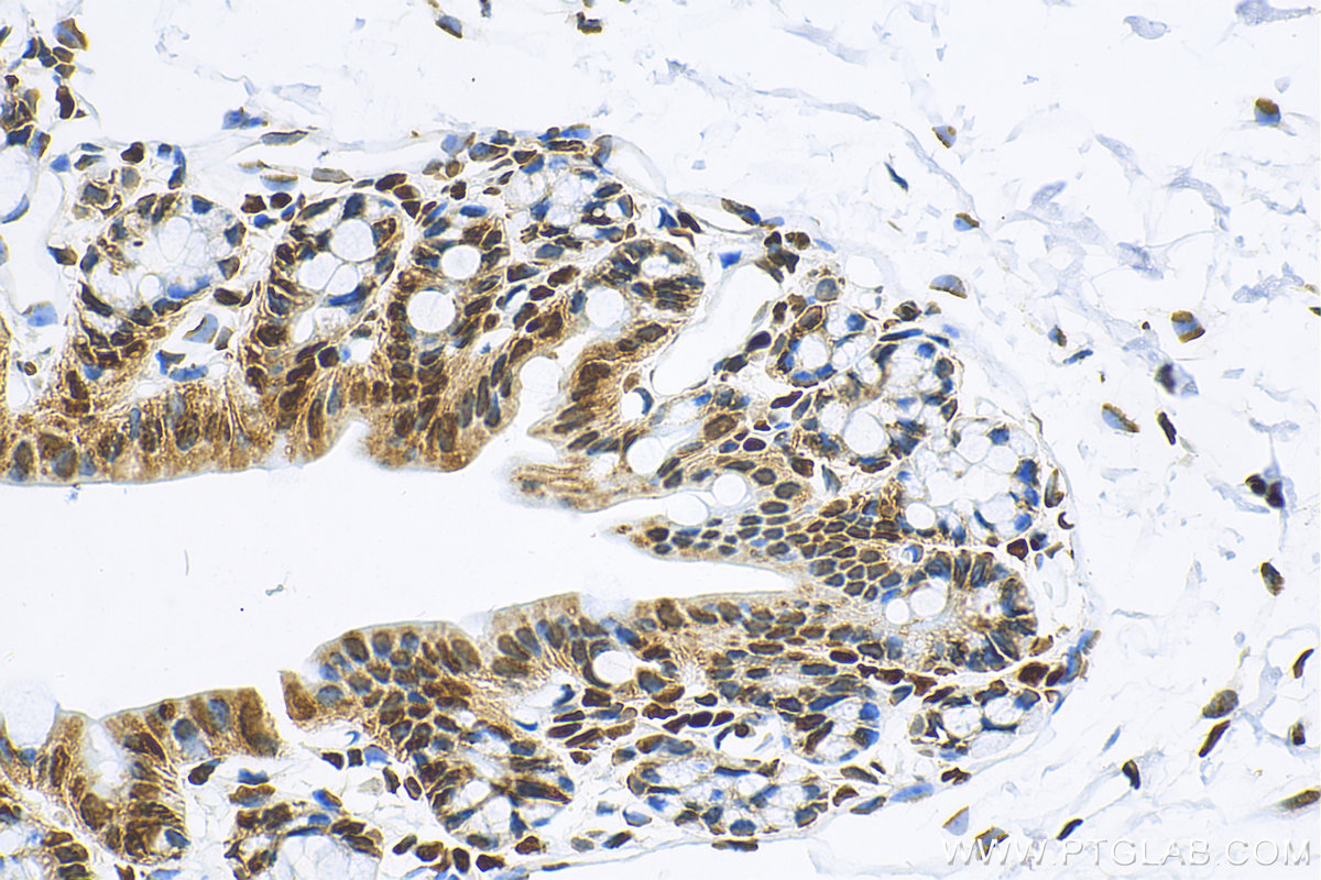 IHC staining of mouse colon using 82798-3-RR (same clone as 82798-3-PBS)