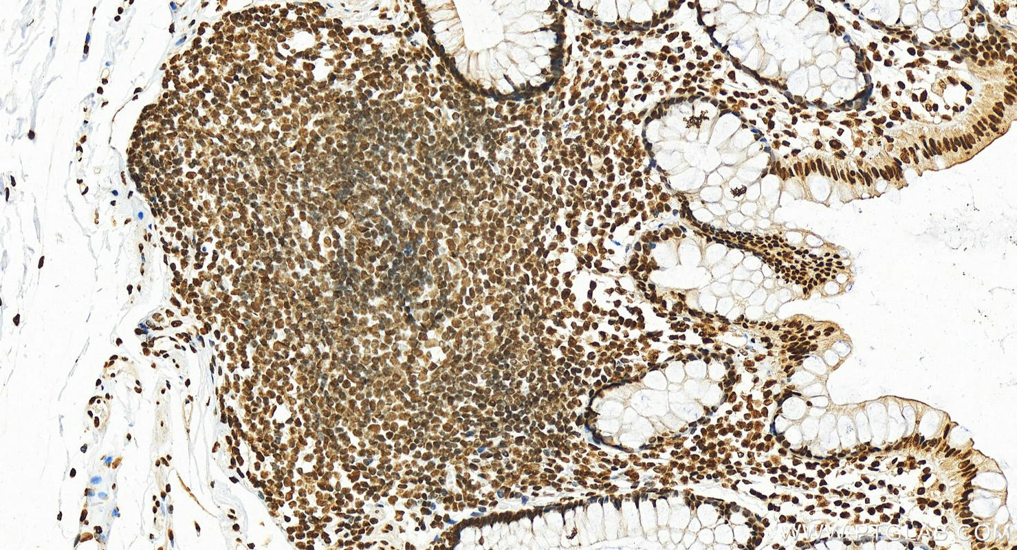 IHC staining of human normal colon using 12770-1-AP