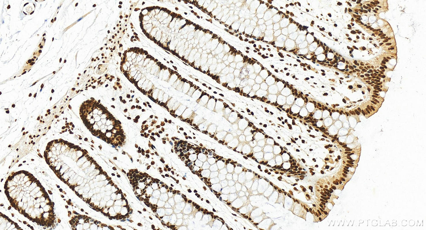 IHC staining of human normal colon using 12770-1-AP