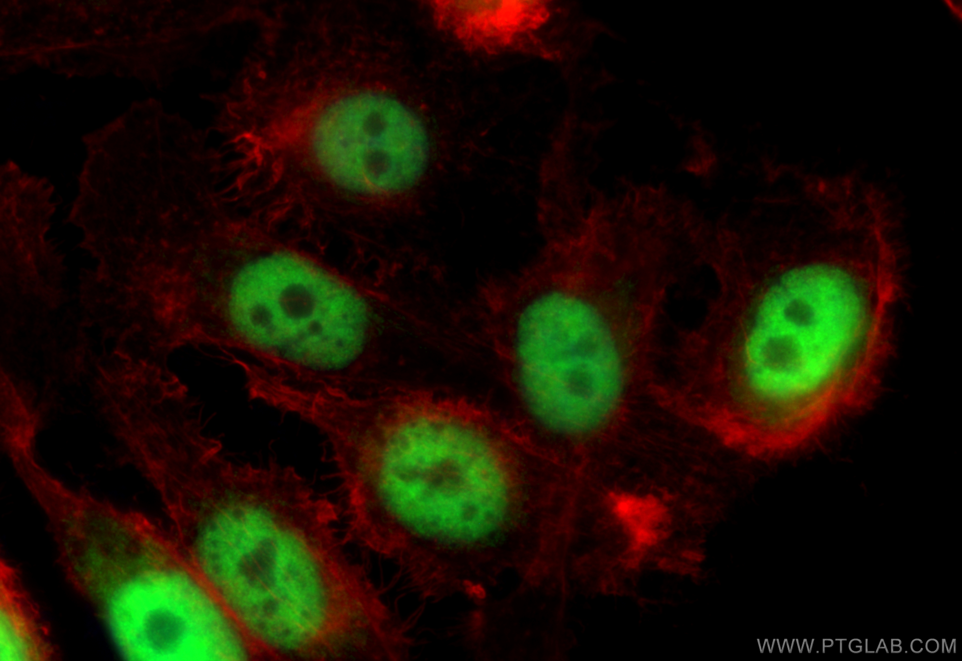 IF Staining of PC-3 using 17674-1-AP