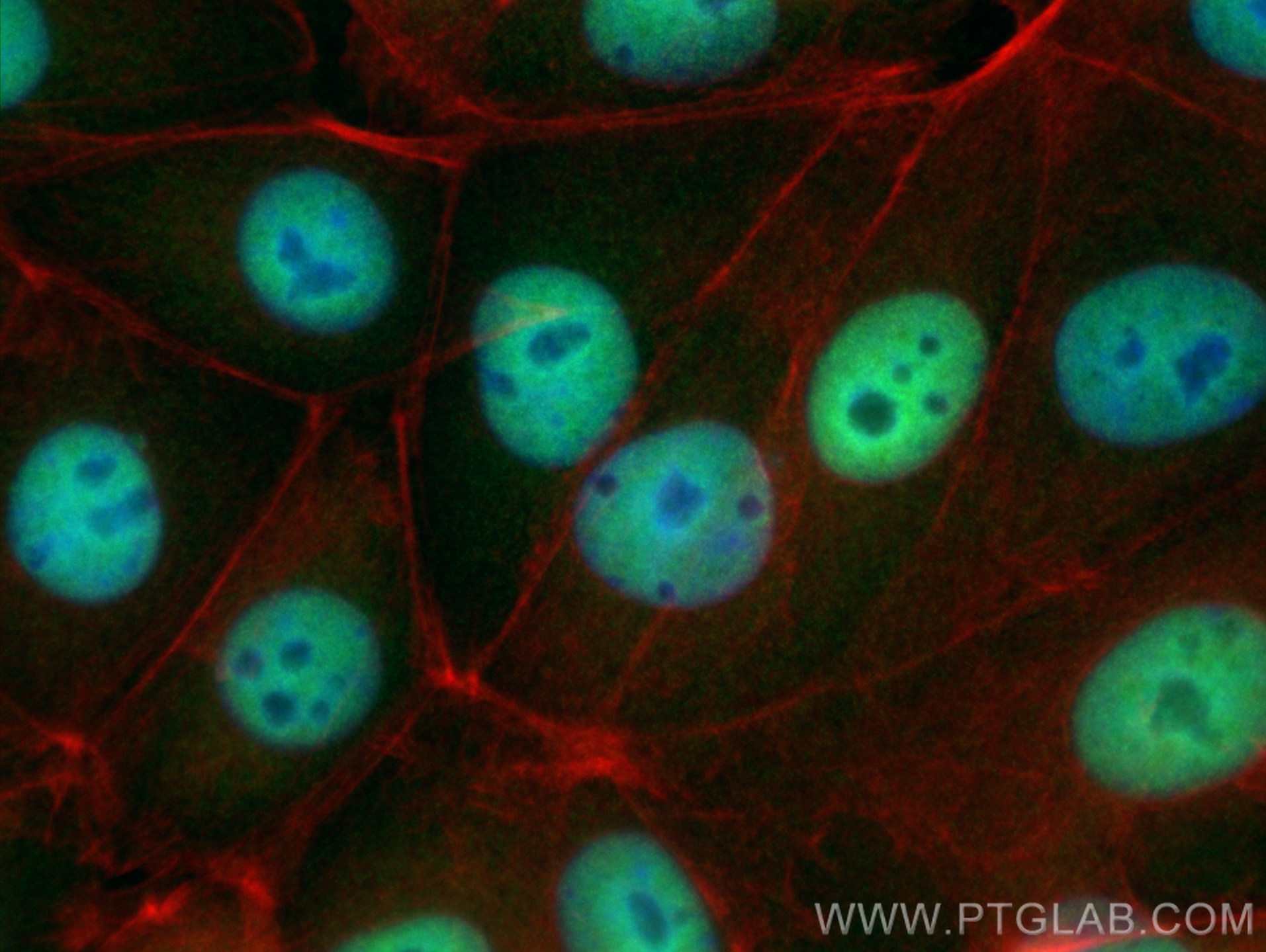 IF Staining of MCF-7 using 20143-1-AP