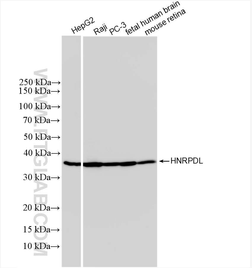 WB analysis using 83129-5-RR (same clone as 83129-5-PBS)