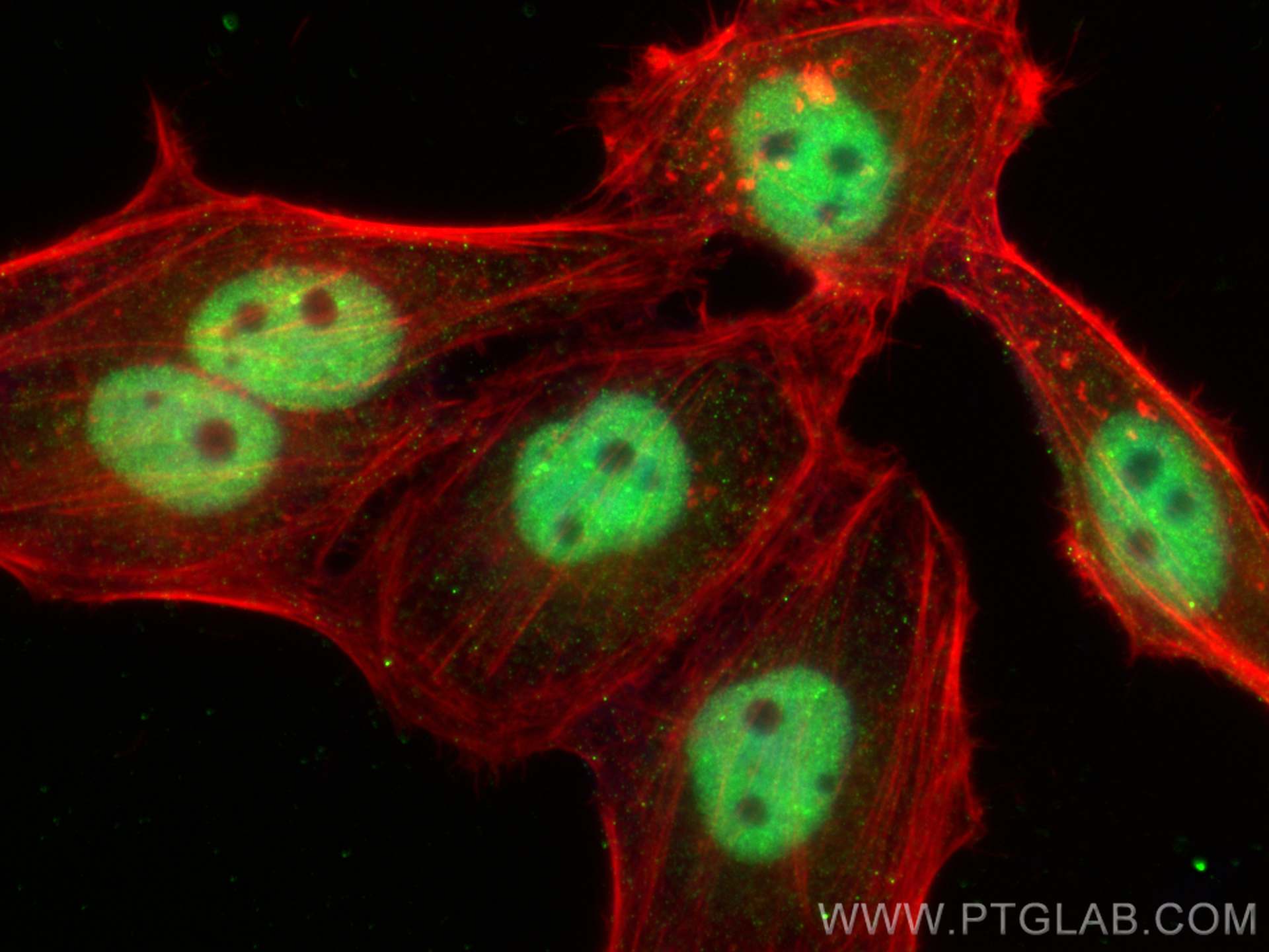 IF Staining of HepG2 using 26769-1-AP