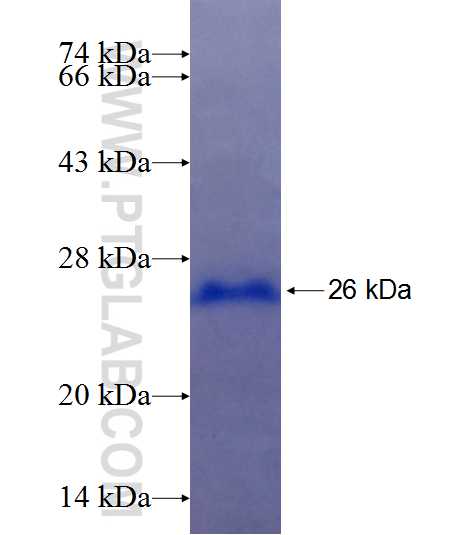 HNRPLL fusion protein Ag25298 SDS-PAGE