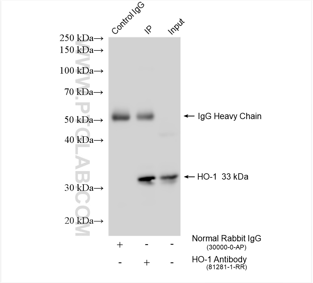 IP experiment of HeLa using 81281-1-RR