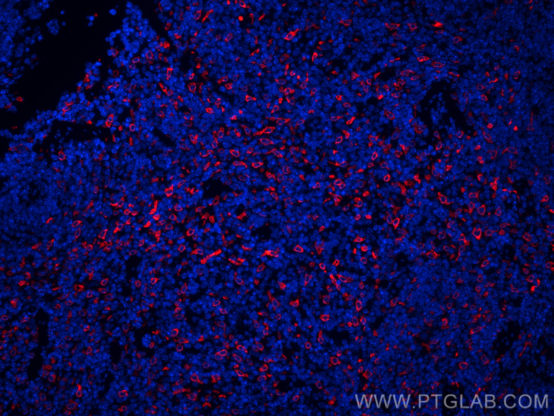 IF Staining of mouse spleen using CL594-66743
