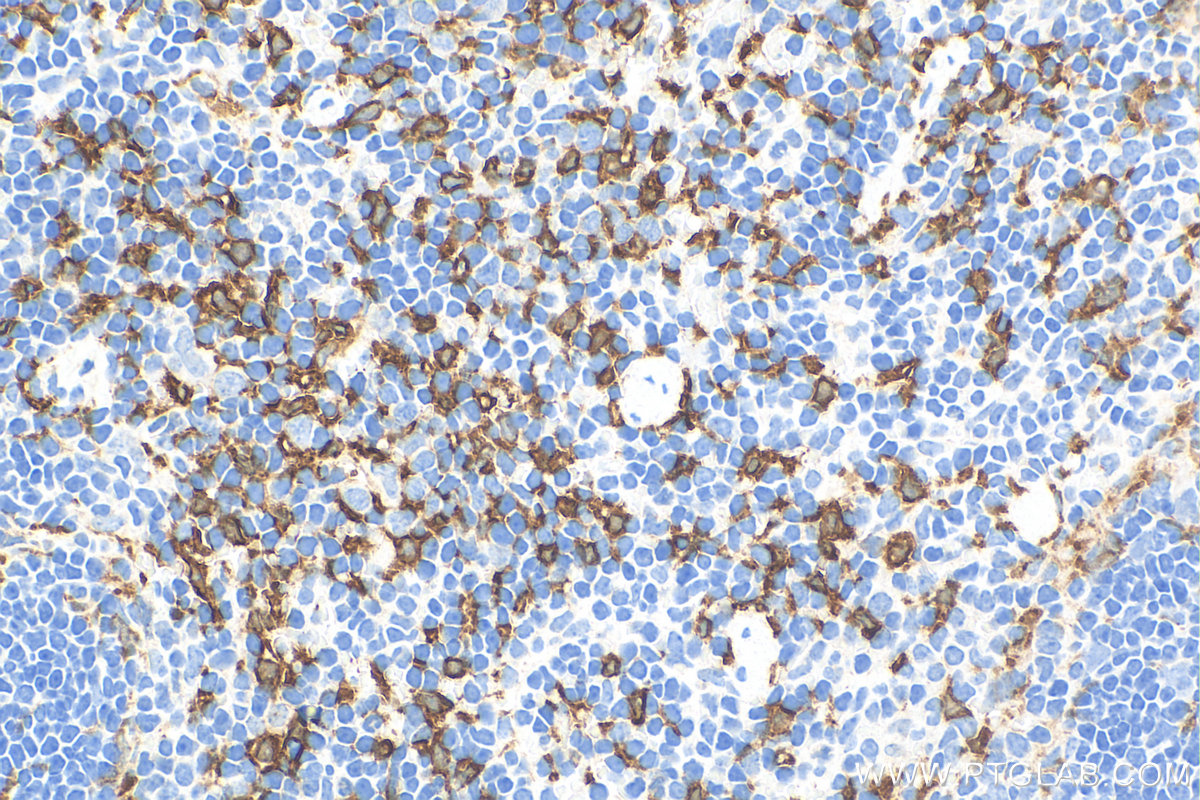 IHC staining of mouse spleen using 83291-3-RR (same clone as 83291-3-PBS)