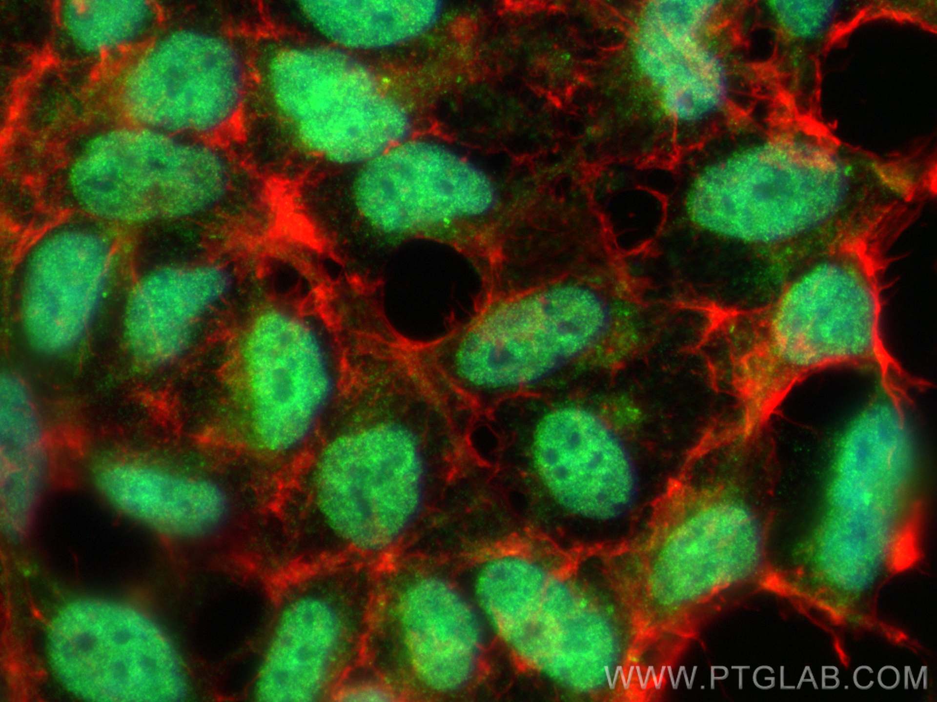 IF Staining of HEK-293 using 23965-1-AP