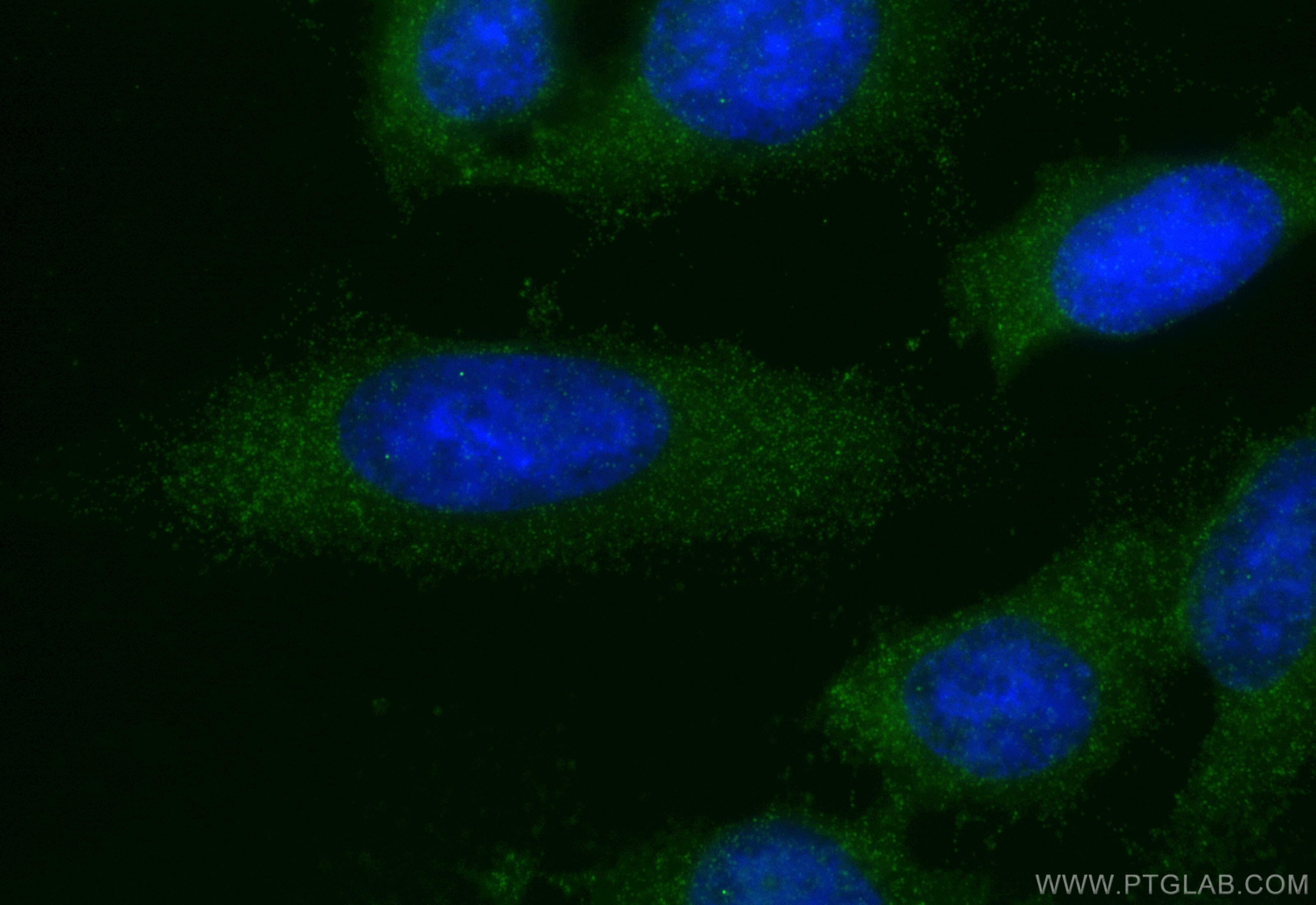 IF Staining of HeLa using 12458-1-AP