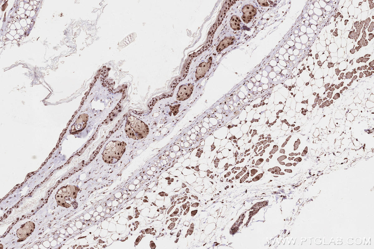 IHC staining of mouse skin using 28719-1-AP