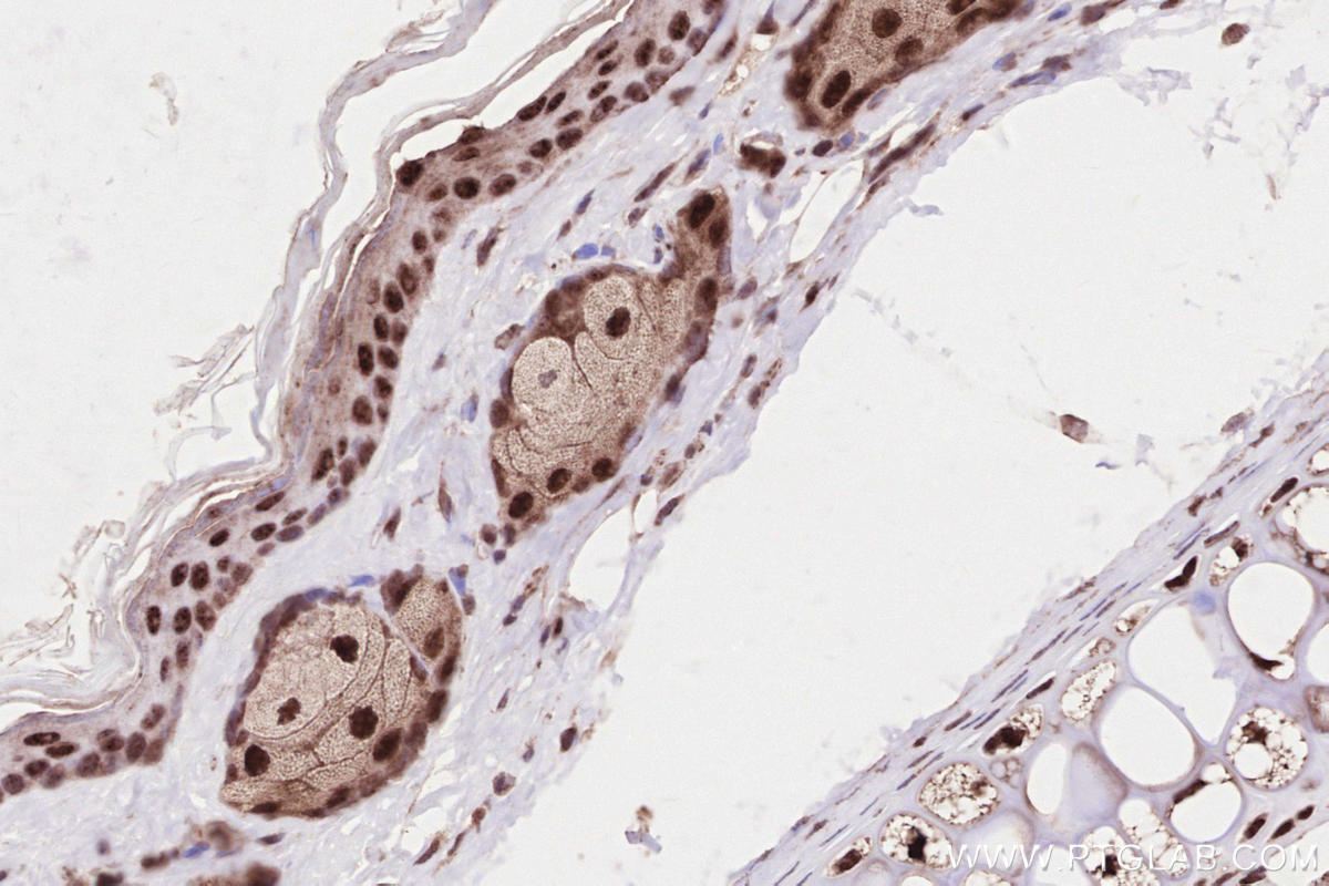 IHC staining of mouse skin using 28719-1-AP