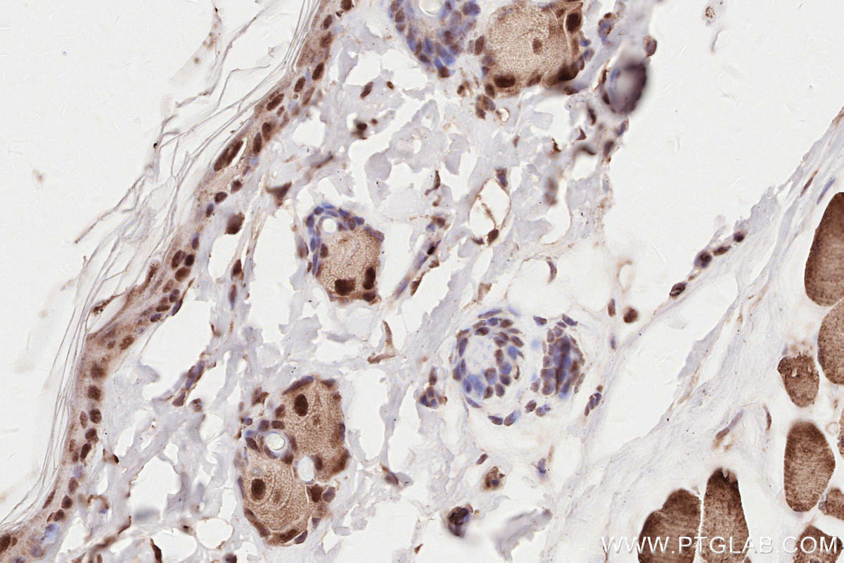 IHC staining of rat skin using 28719-1-AP