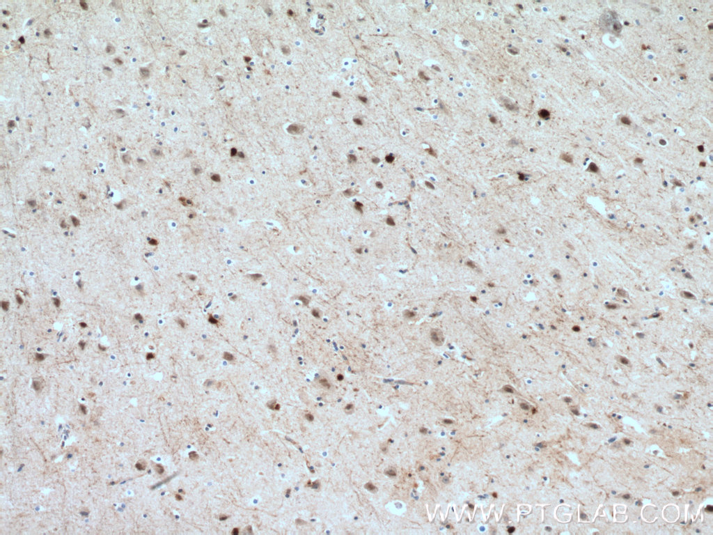 IHC staining of human brain using 18210-1-AP