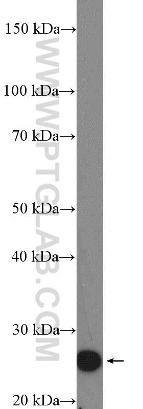 WB analysis of mouse brain using 18210-1-AP