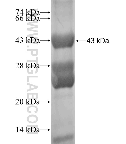 HOXA7 fusion protein Ag18927 SDS-PAGE