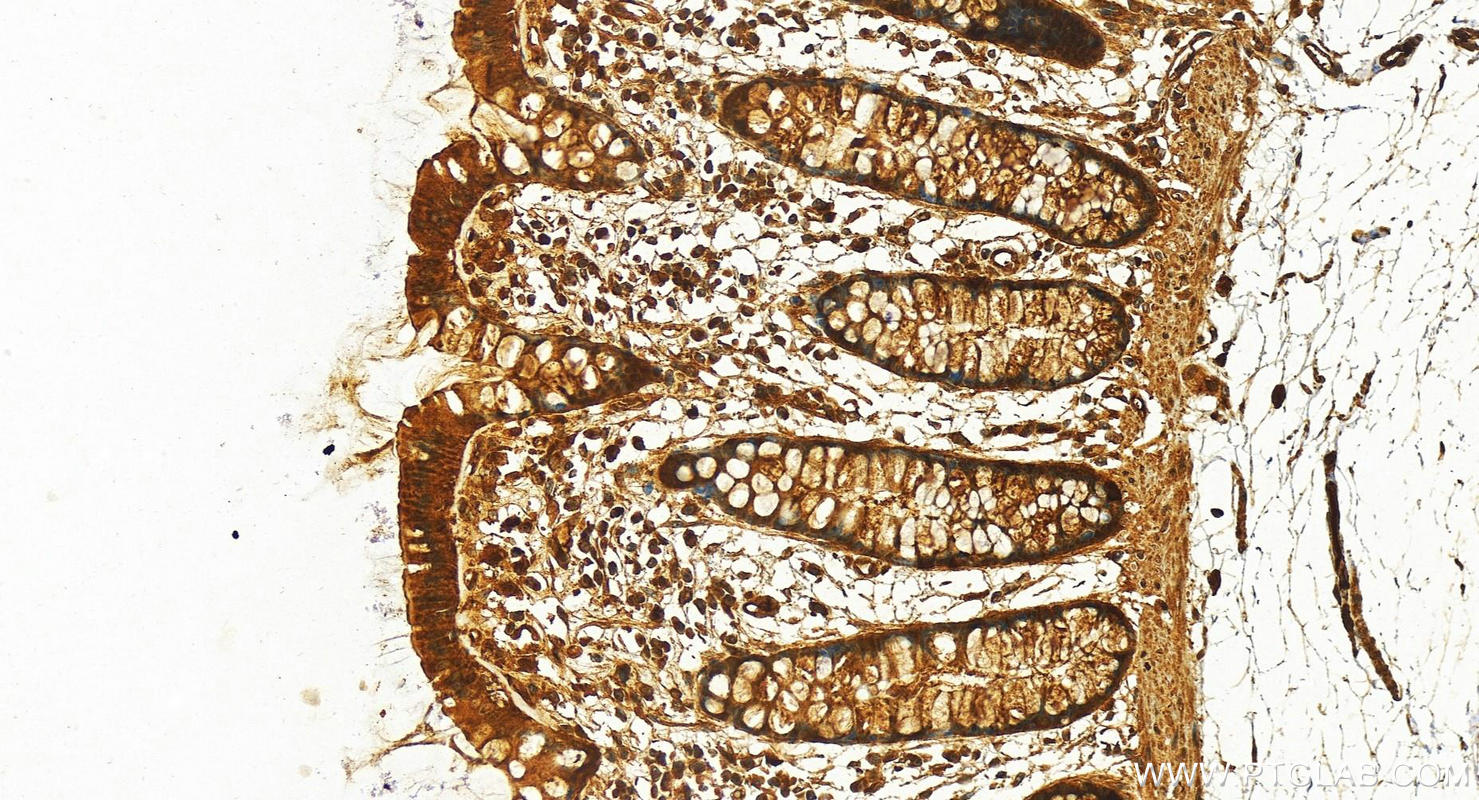 IHC staining of human colon using 29978-1-AP