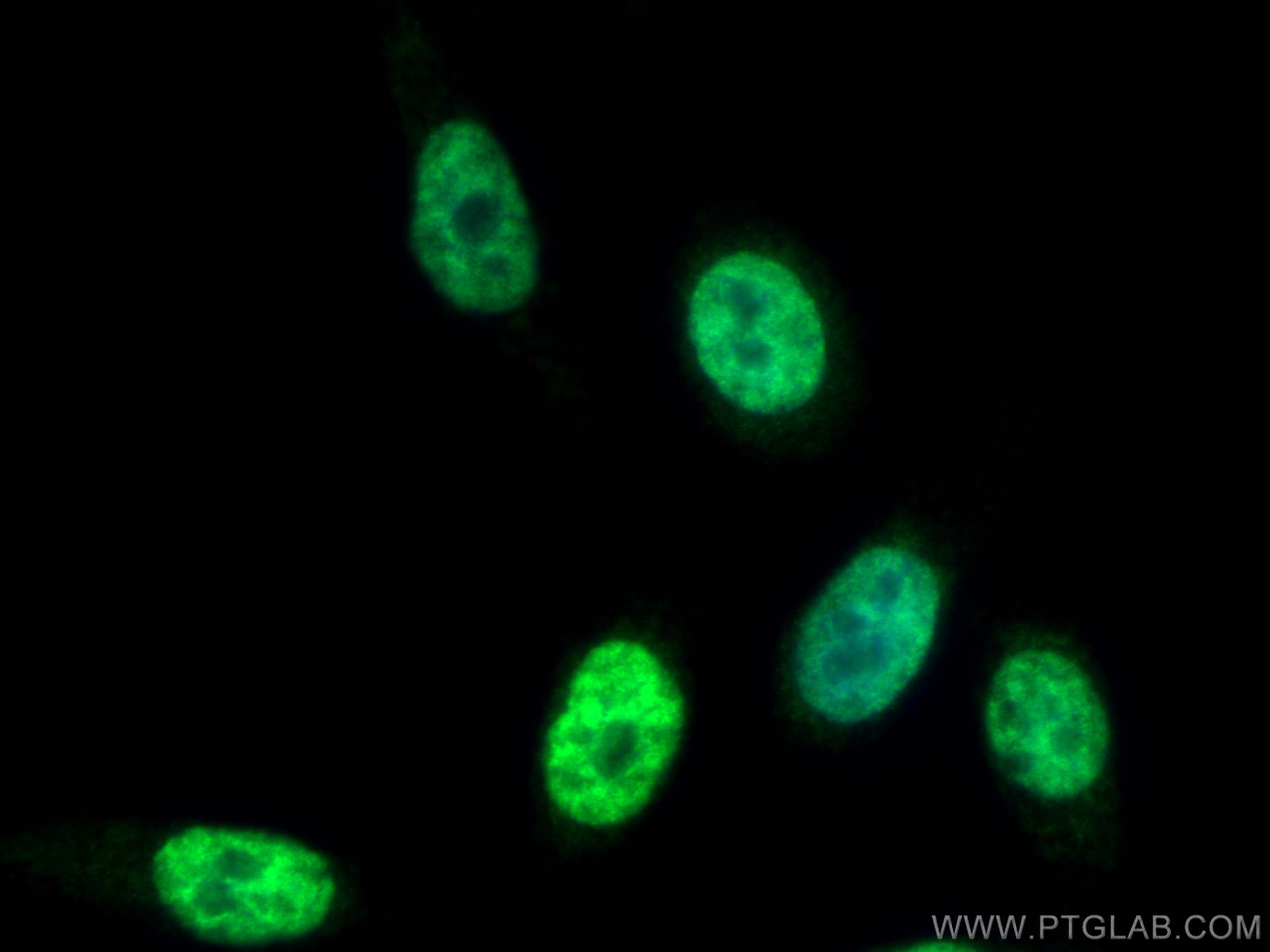 IF Staining of PC-3 using 26384-1-AP