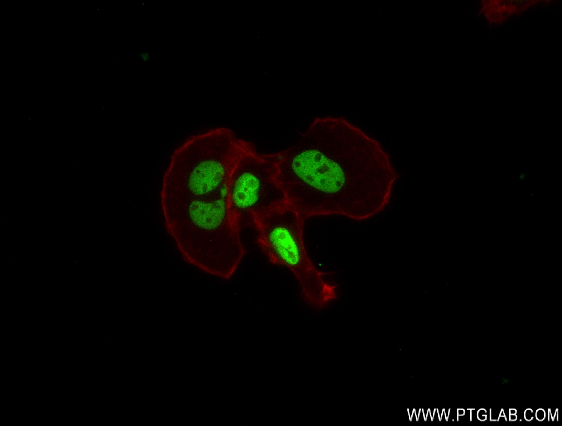 IF Staining of A431 using 83155-4-RR