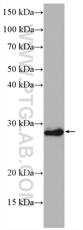 WB analysis of SKOV-3 using 12613-1-AP