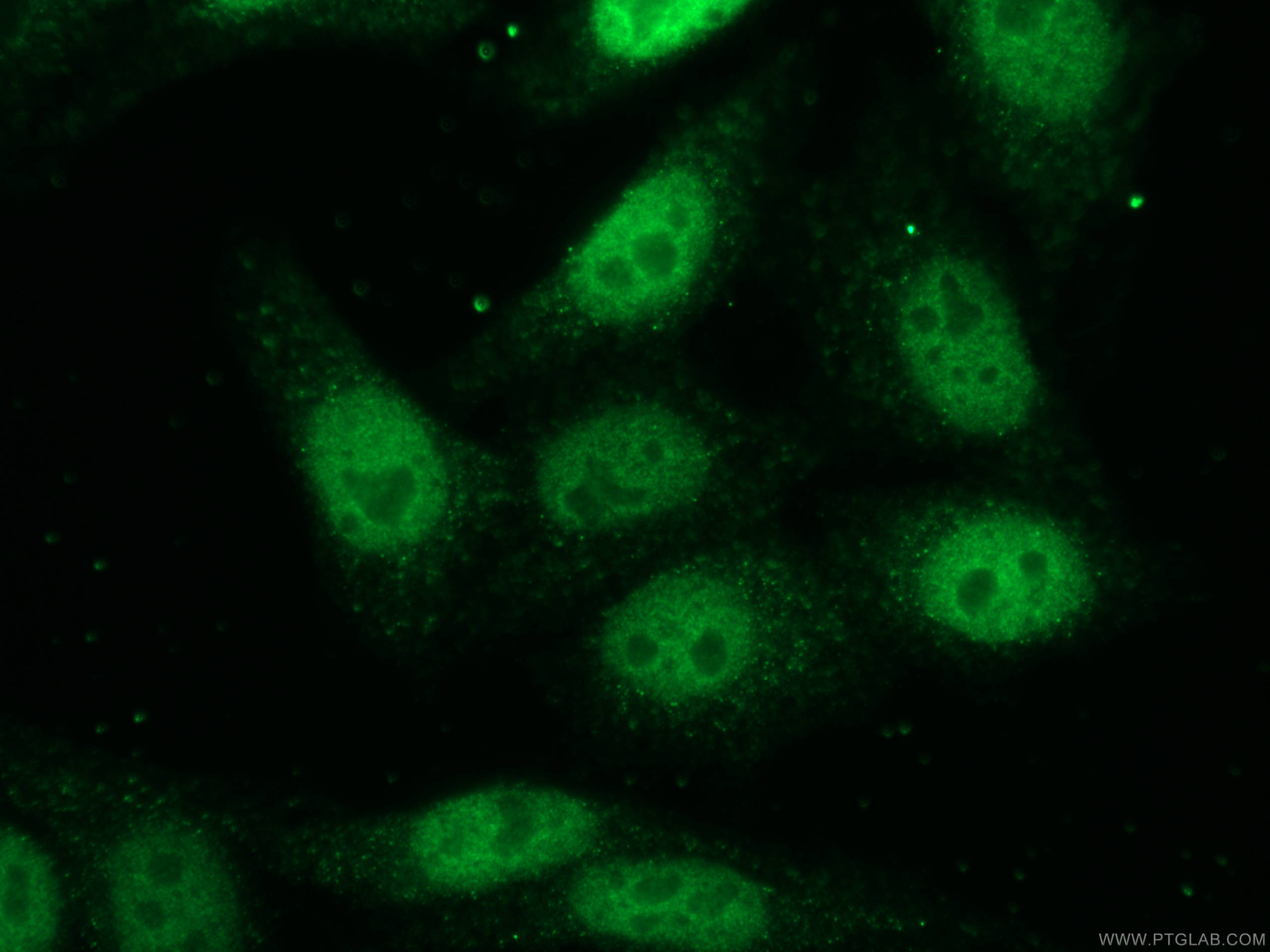 IF Staining of HepG2 using 12025-1-AP