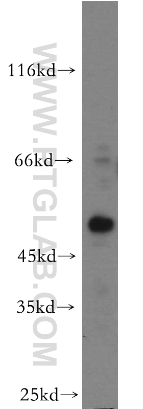 WB analysis of HeLa using 20632-1-AP