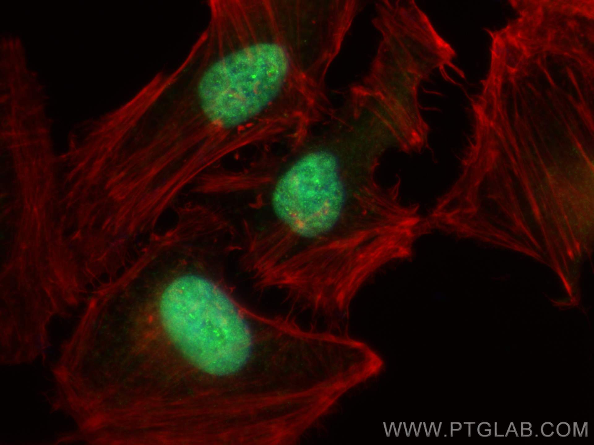 IF Staining of HeLa using 27002-1-AP