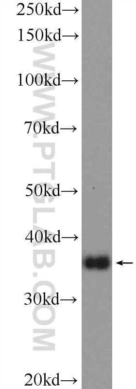 WB analysis of HL-60 using 23520-1-AP