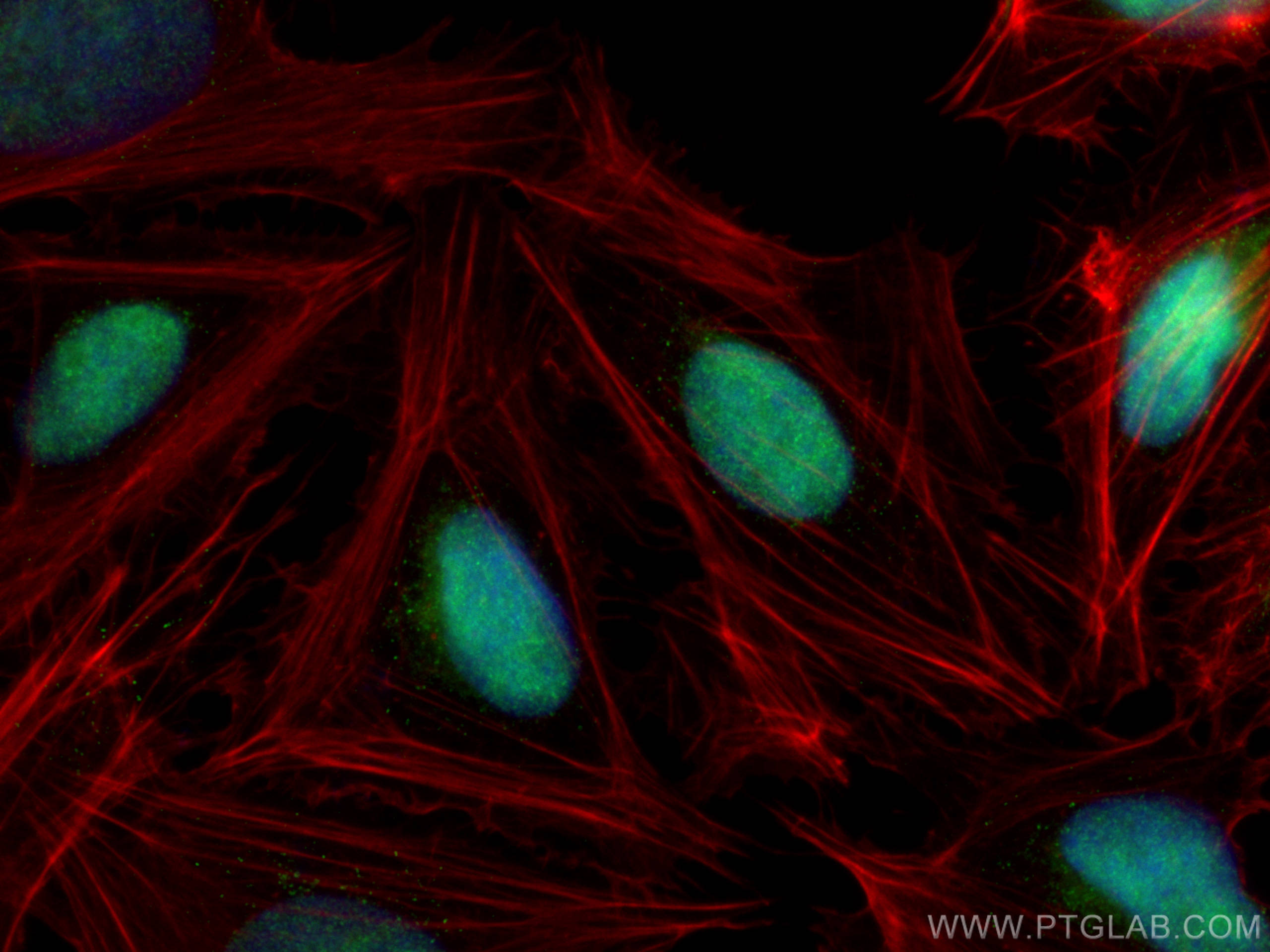 IF Staining of U2OS using 10496-1-AP