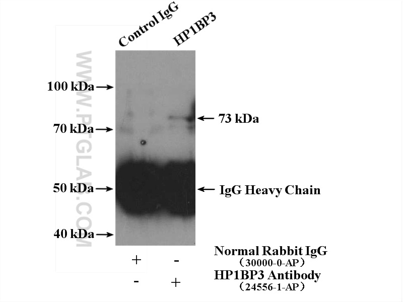 IP experiment of HeLa using 24556-1-AP