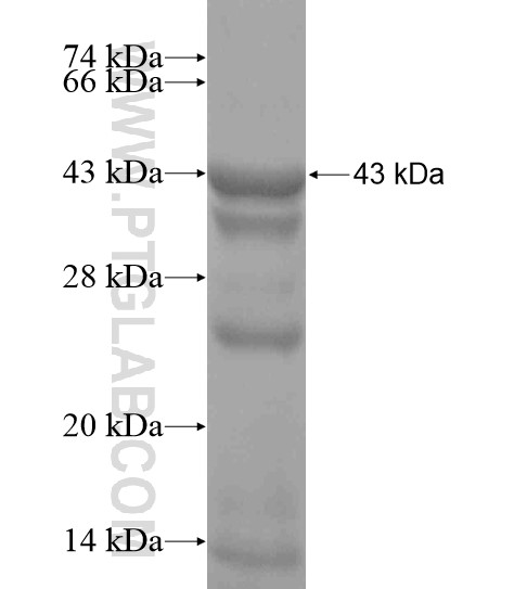 HP1BP3 fusion protein Ag18709 SDS-PAGE