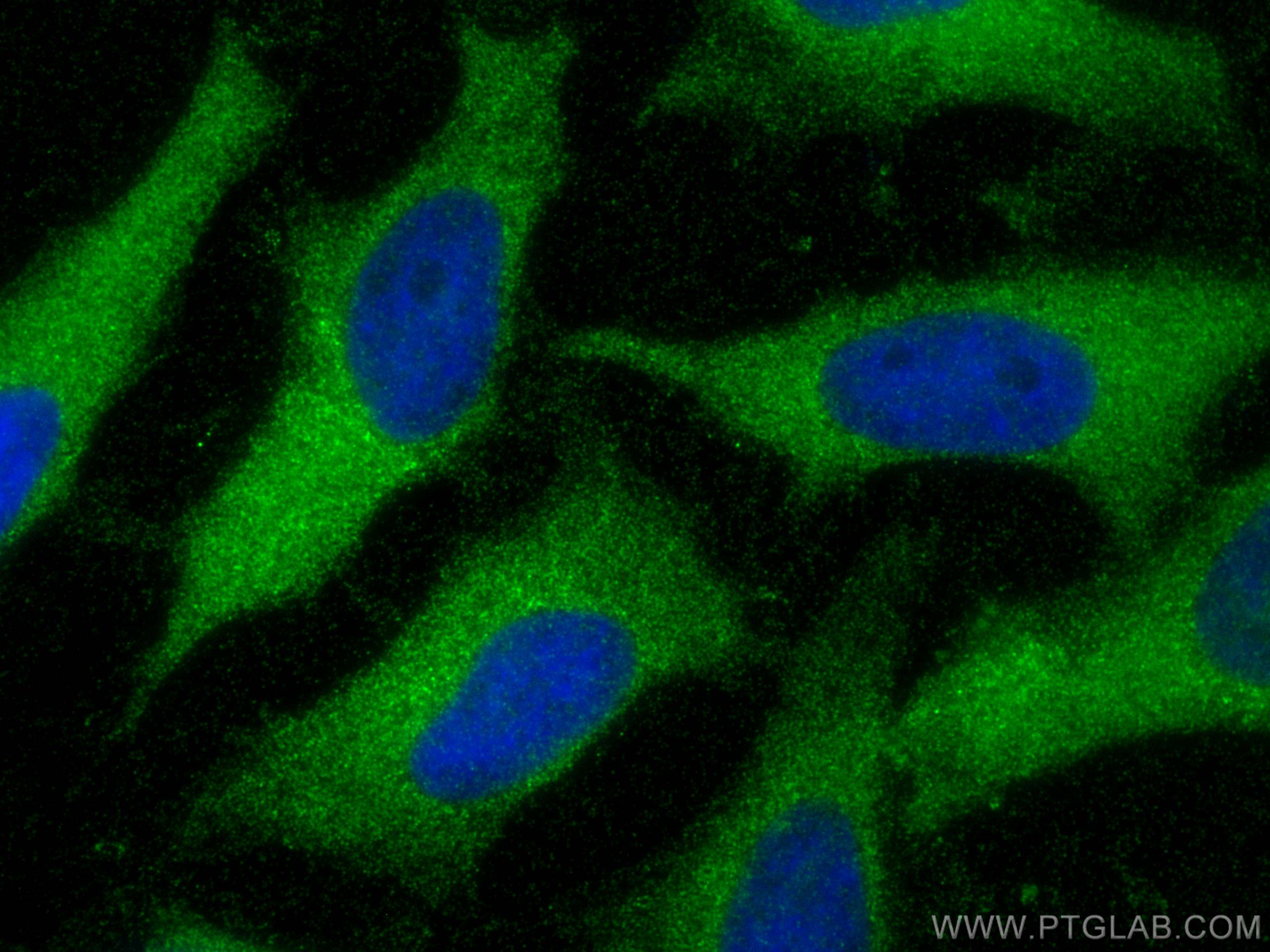 IF Staining of HeLa using 10989-1-AP