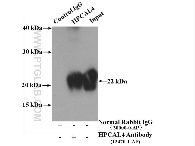 IP experiment of fetal human brain using 12470-1-AP