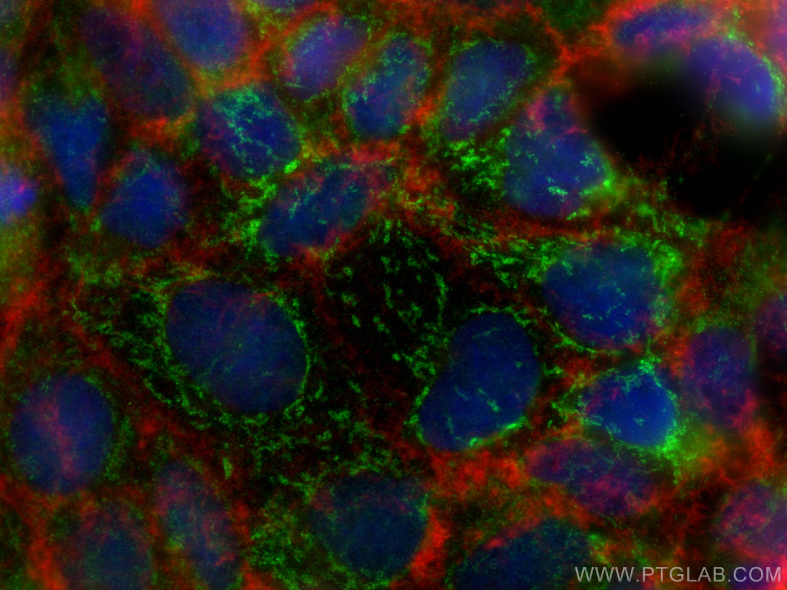 IF Staining of Caco-2 using 20777-1-AP