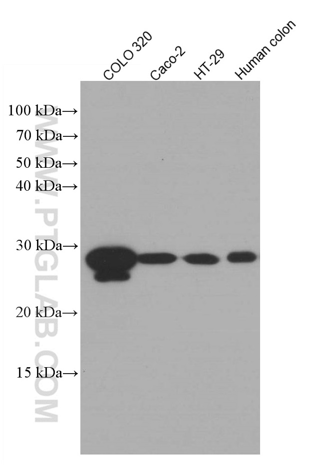 WB analysis using 66798-1-Ig