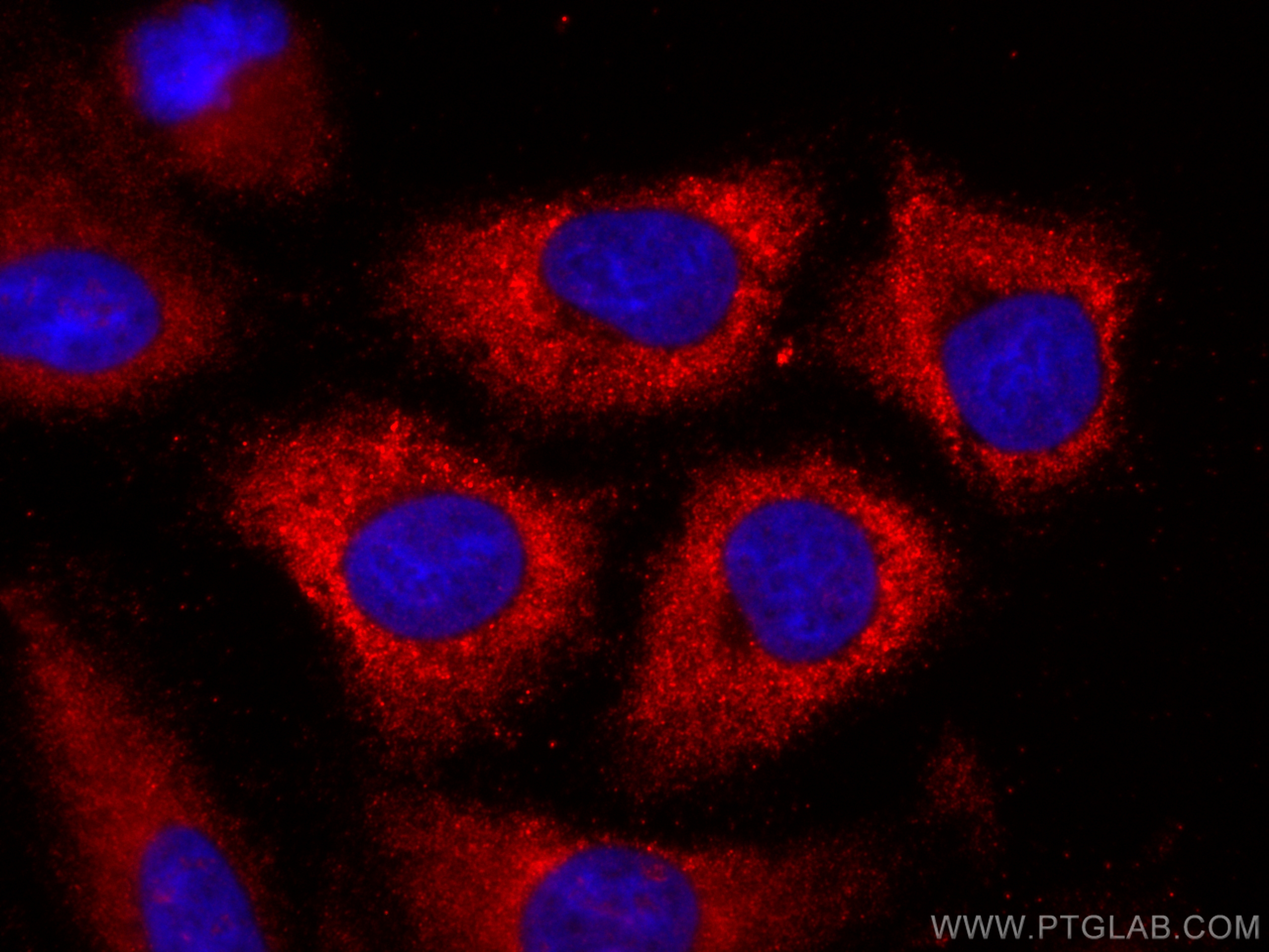 IF Staining of A549 using CL594-66798