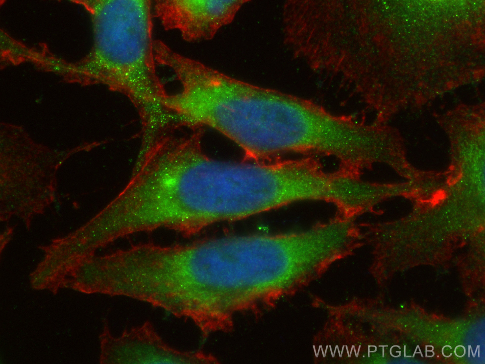 IF Staining of HeLa using 15059-1-AP