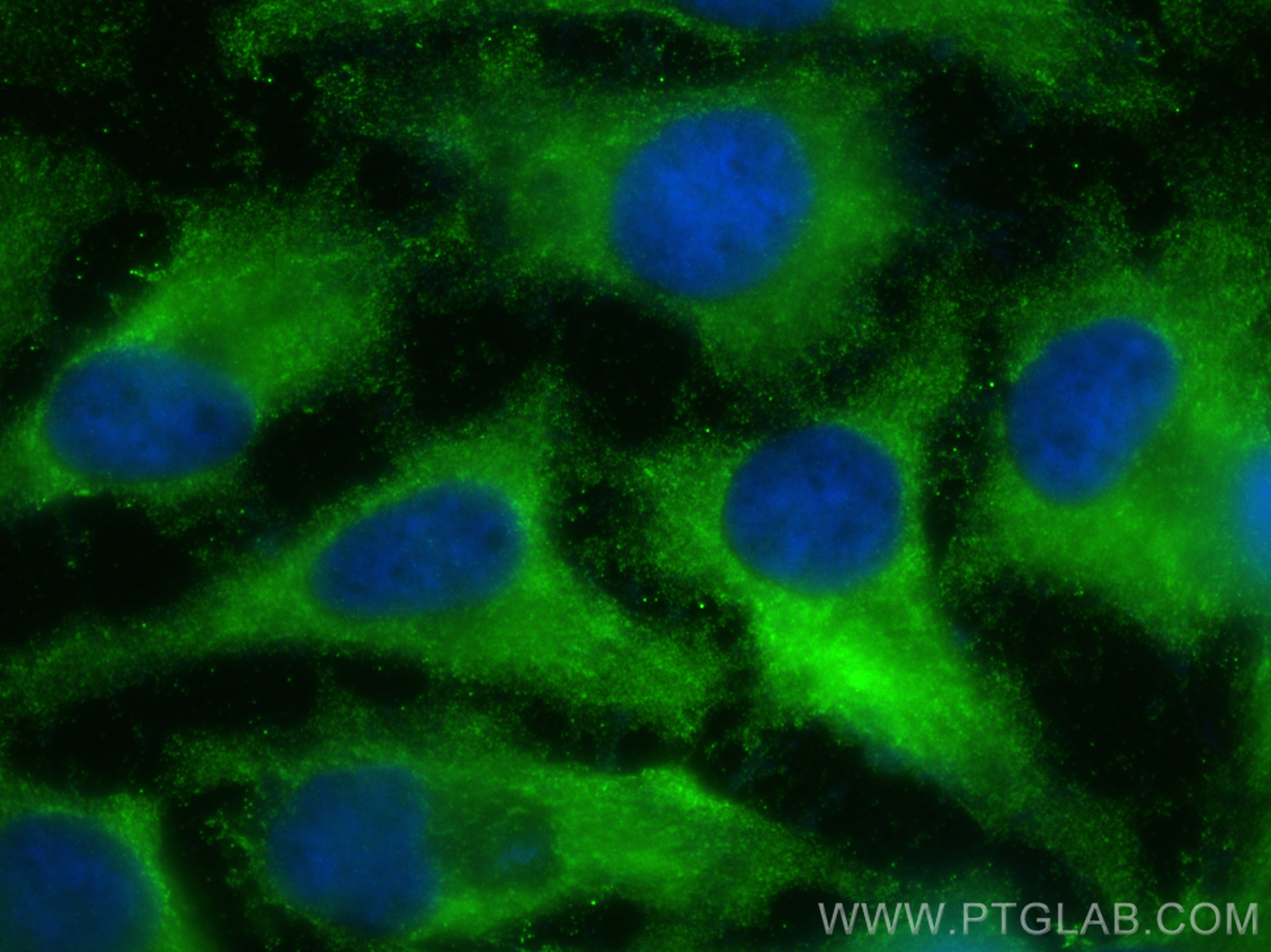 IF Staining of HeLa using 67518-1-Ig