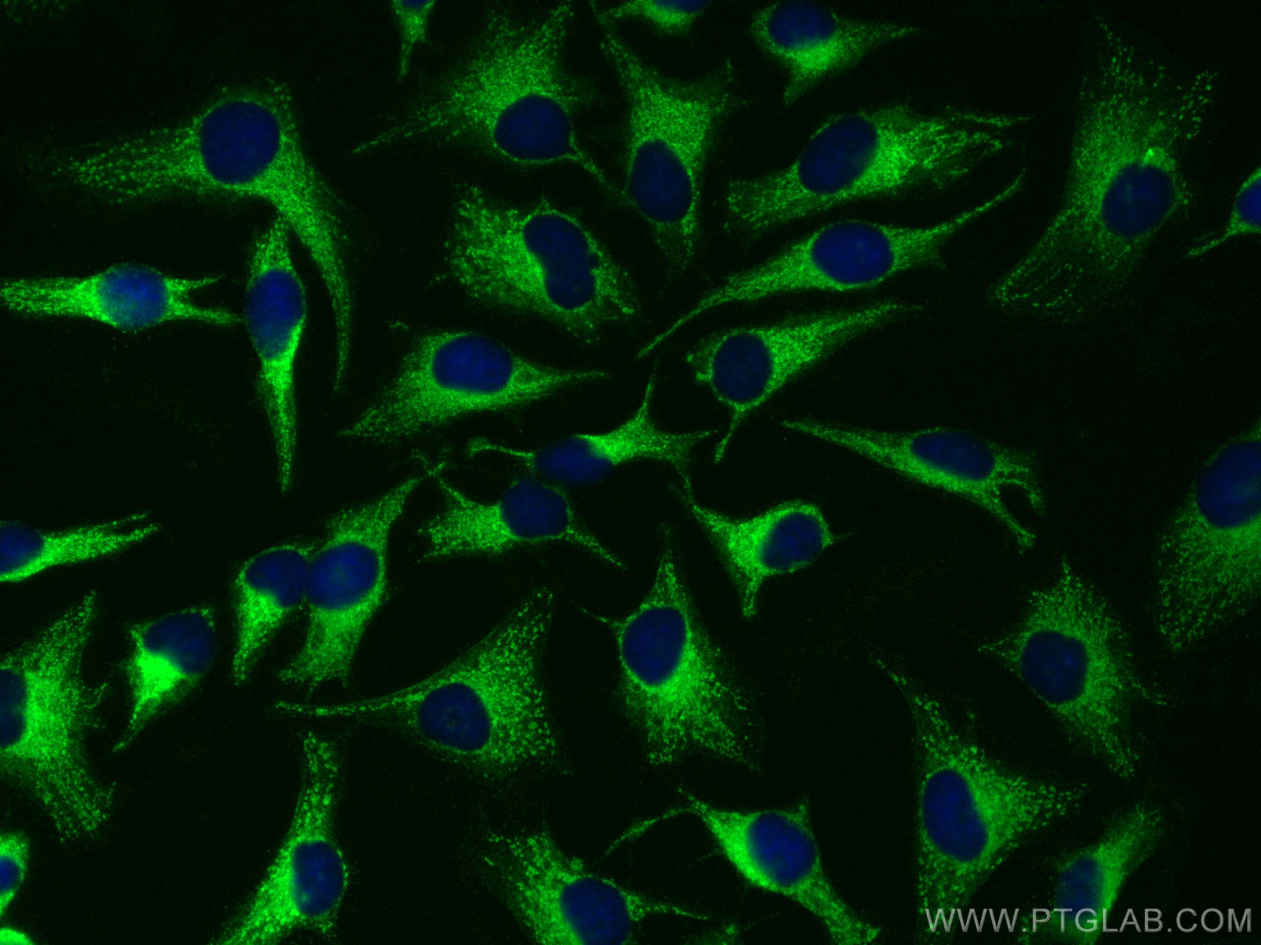 IF Staining of HeLa using 10768-1-AP