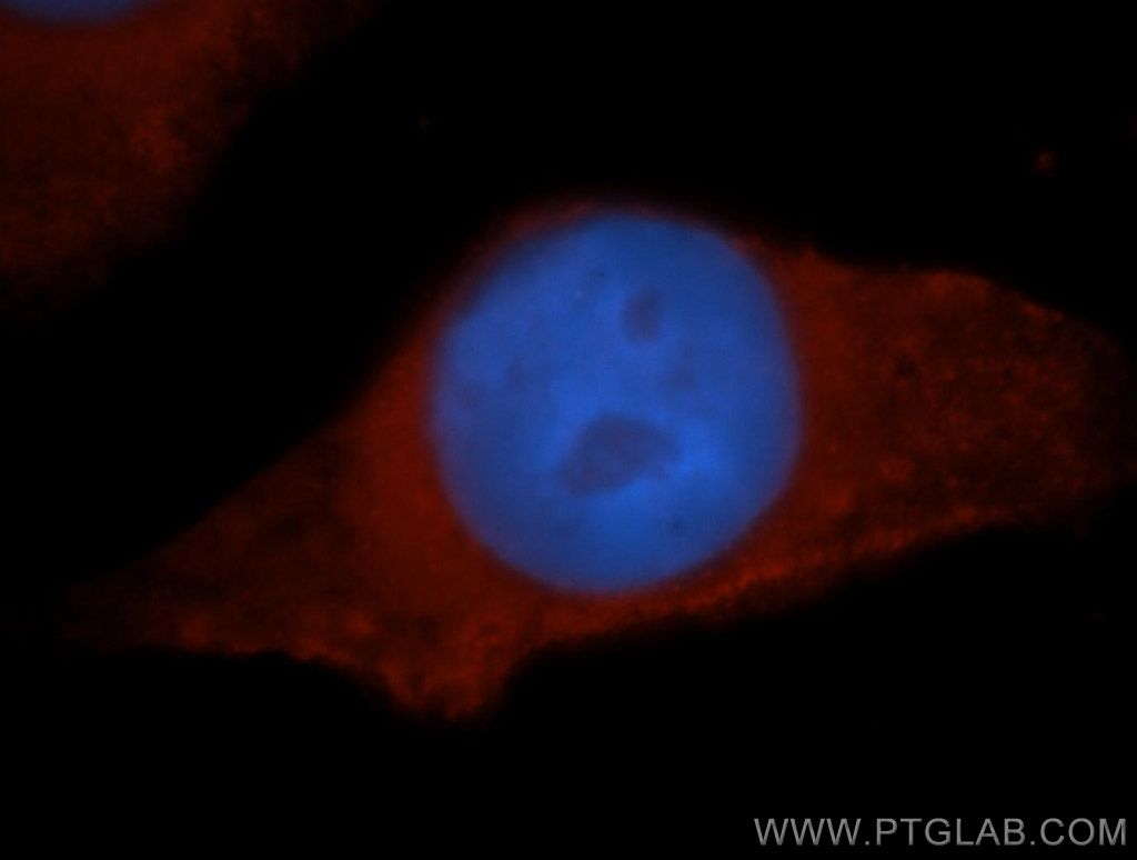 IF Staining of MCF-7 using 13901-1-AP