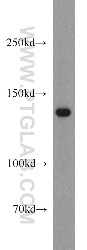 WB analysis of mouse liver using 13901-1-AP (same clone as 13901-1-PBS)