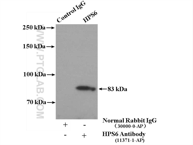 IP experiment of HeLa using 11371-1-AP