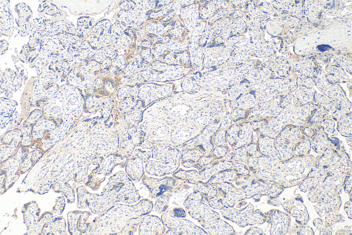 IHC staining of human placenta using 84562-1-RR (same clone as 84562-1-PBS)