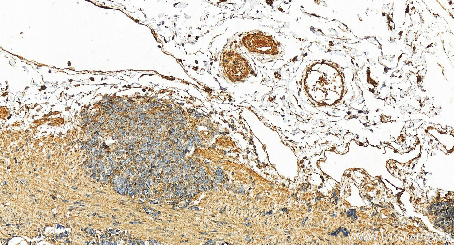 IHC staining of human stomach using 15531-1-AP